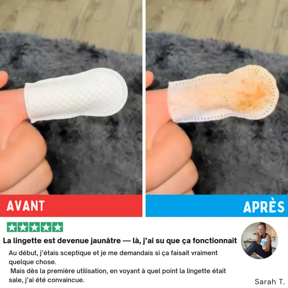 Lingettes Dentaires ProCare